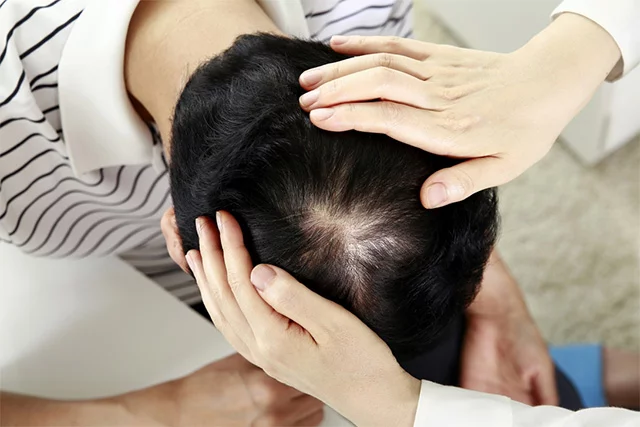 두피 관리
