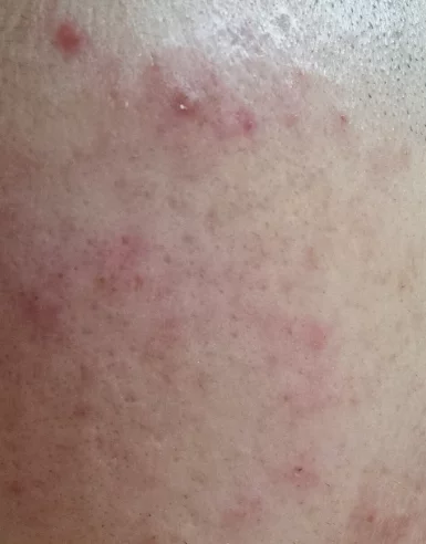 남자 피부 좋아지는 법